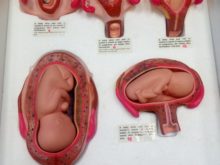 Zimeková - beseda-5.jpg